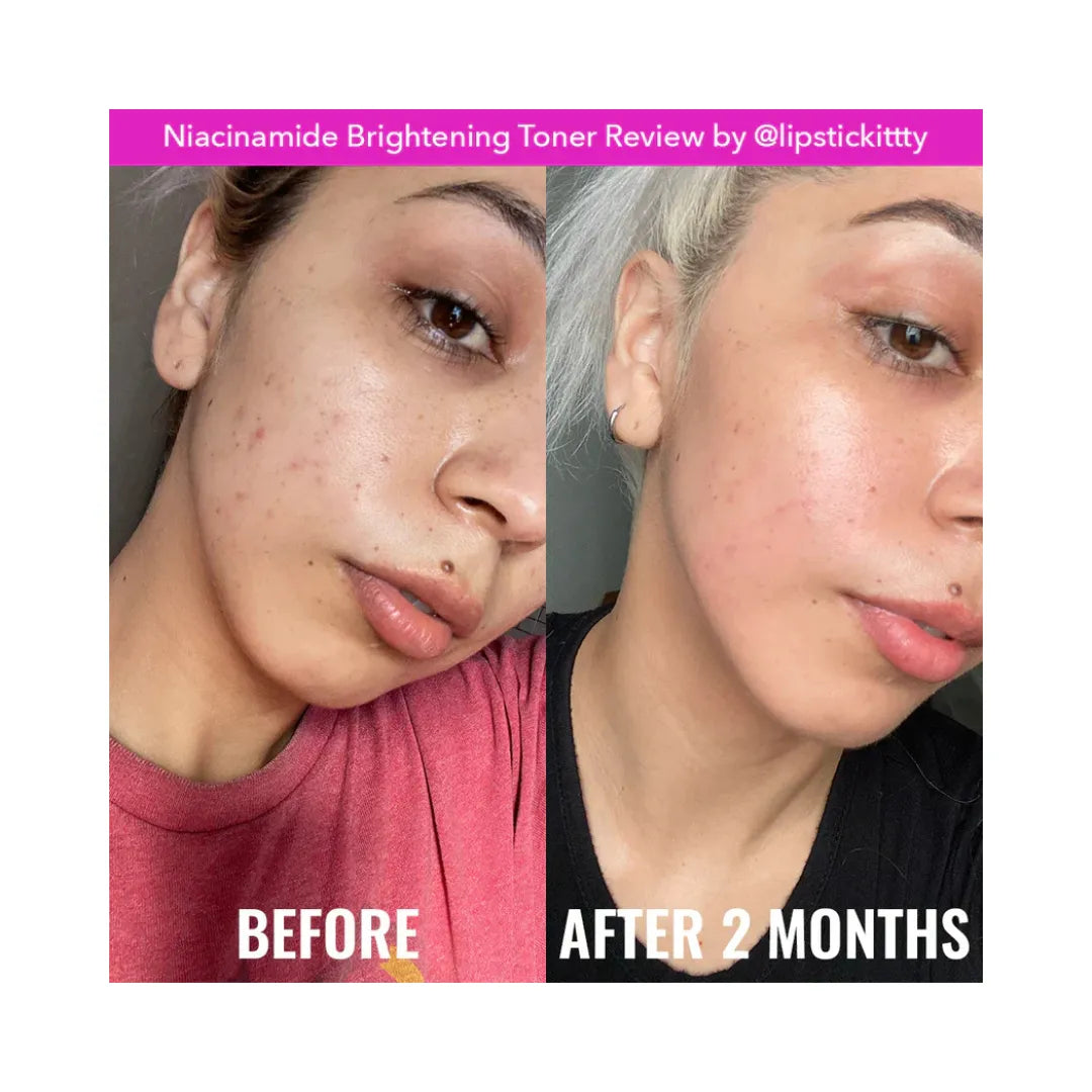 GOOD MOLECULES Niacinamide Brightening Toner