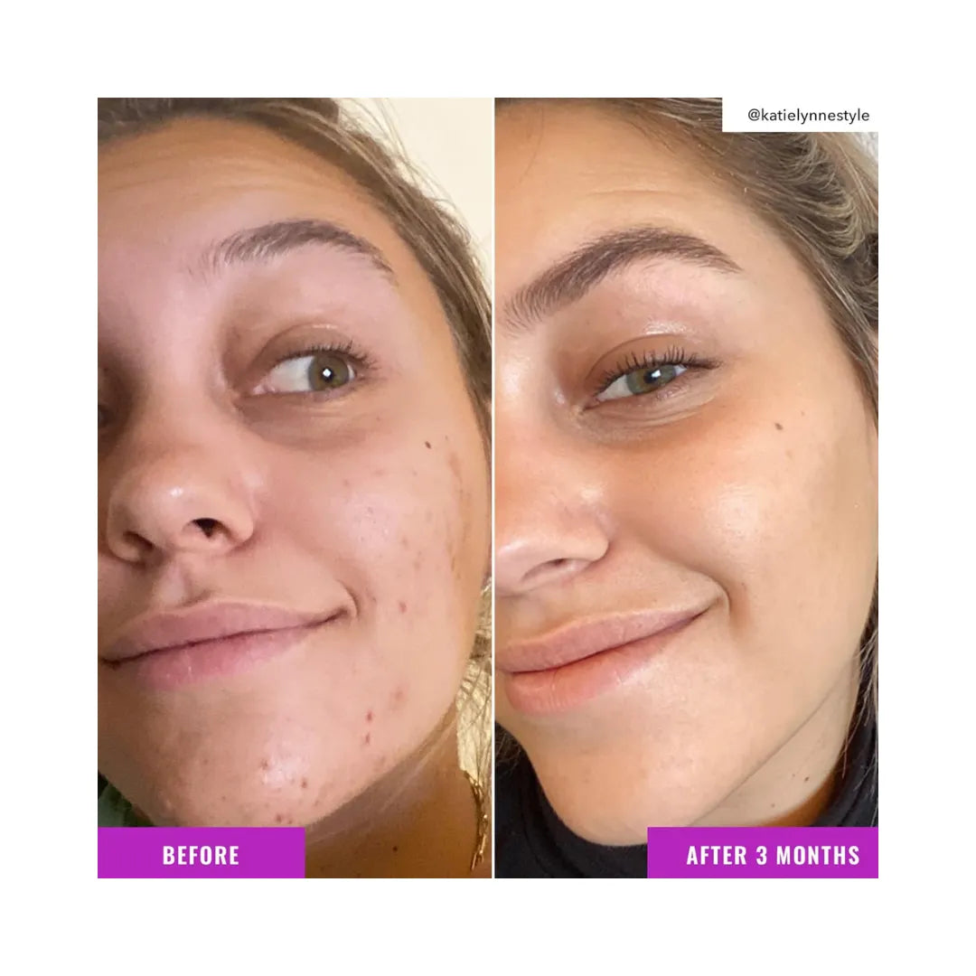 GOOD MOLECULES Niacinamide Brightening Toner