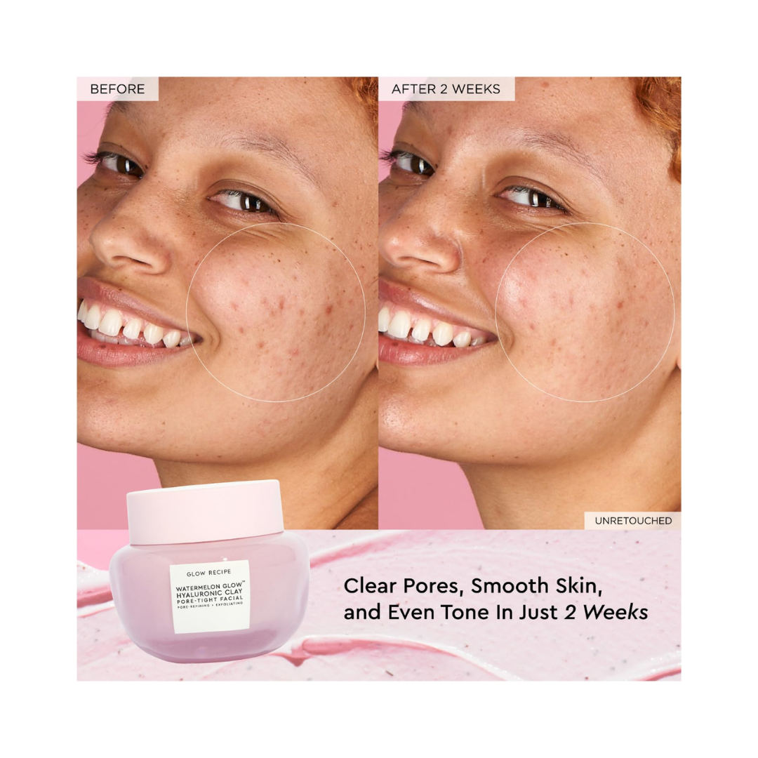 GLOW RECIPE Watermelon Glow Hyaluronic Clay Pore-Tight Facial
