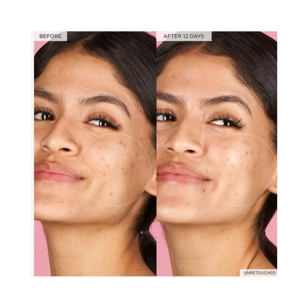 GLOW RECIPE Watermelon Glow Hyaluronic Clay Pore-Tight Facial