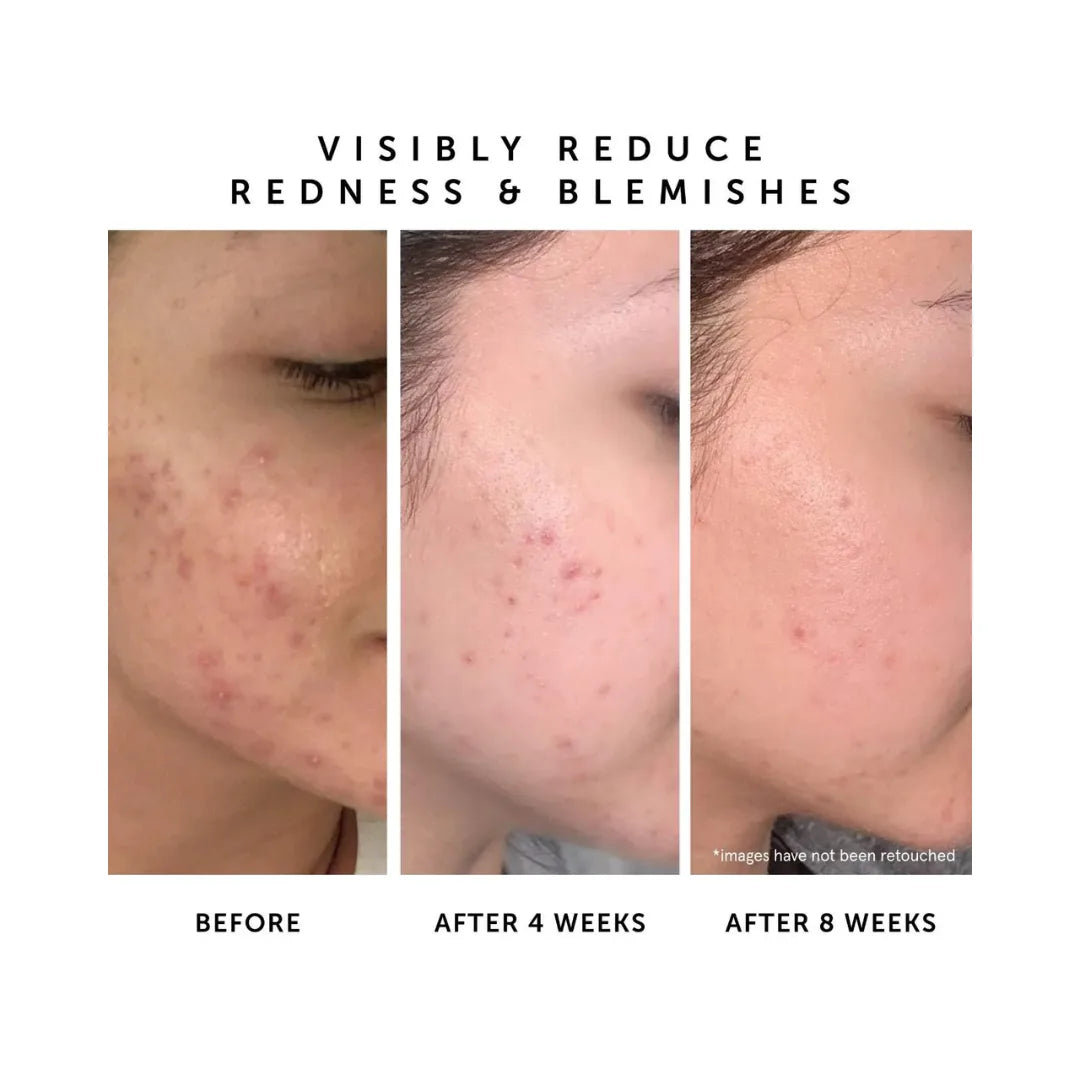 HERBIVORE Lapis Blue Tansy Face Oil