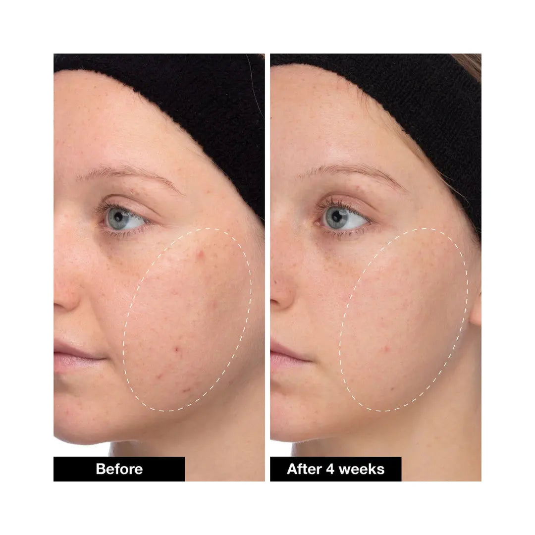 INNBEAUTY PROJECT Slushy Serum Moisturizer Crush Infused with Bakuchiol