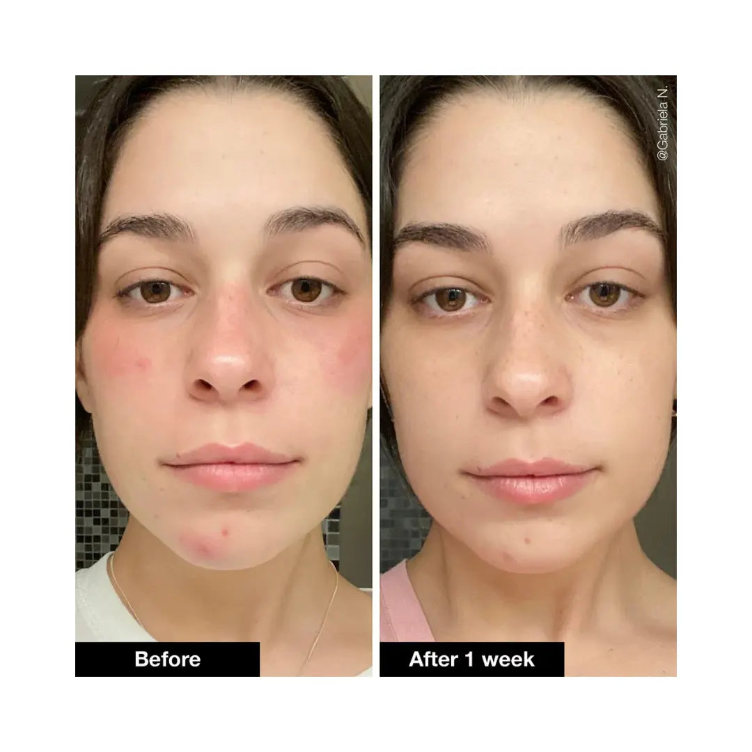 INNBEAUTY PROJECT Slushy Serum Moisturizer Crush Infused with Bakuchiol