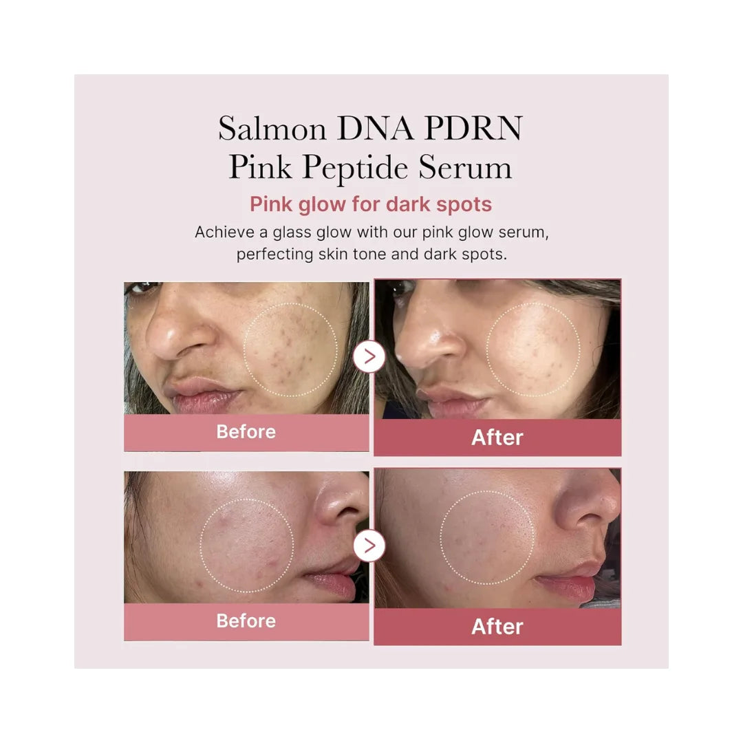 MEDICUBE Salmon DNA PDRN Pink Peptide Serum