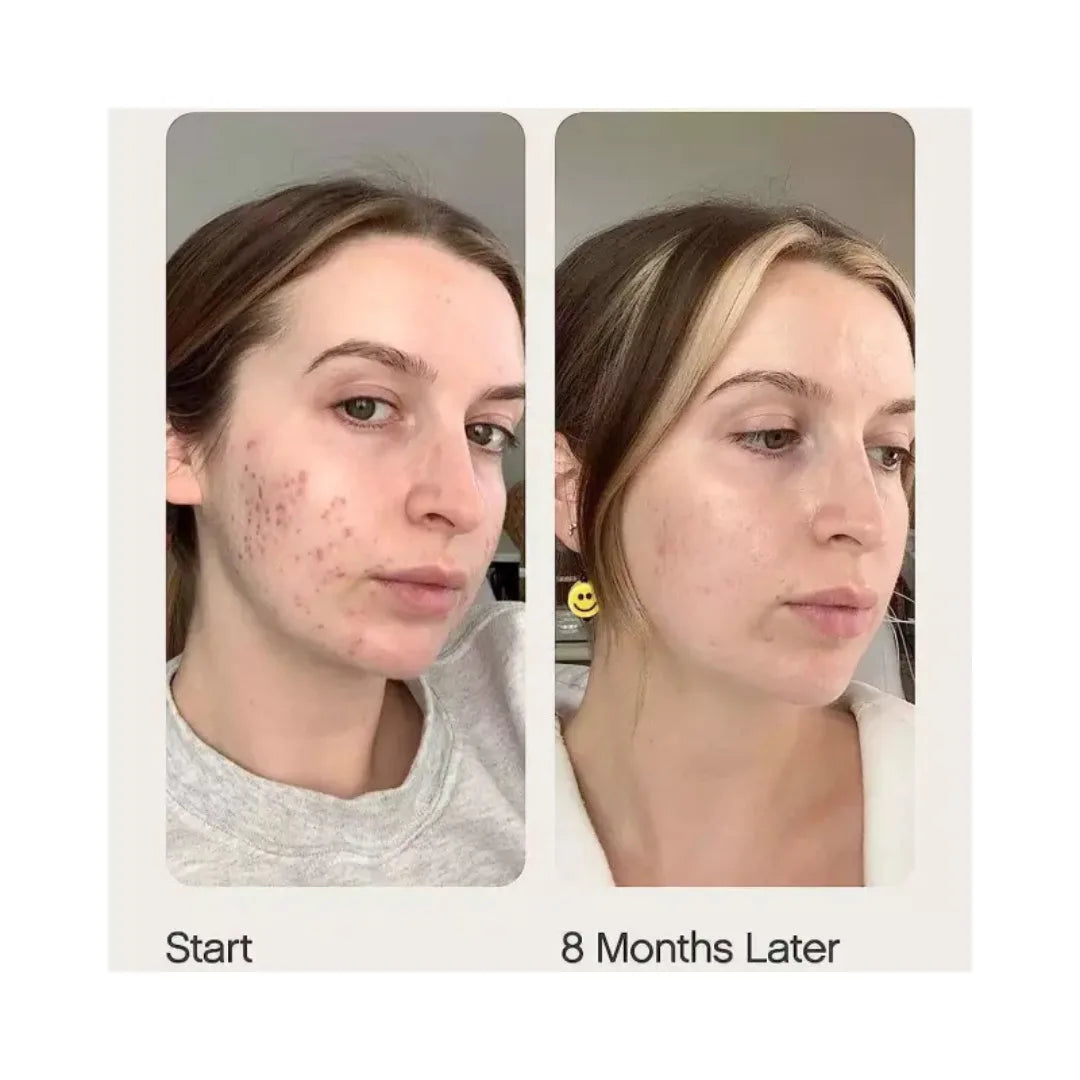 TROPICALS Faded Serum for Dark Spots & Discoloration