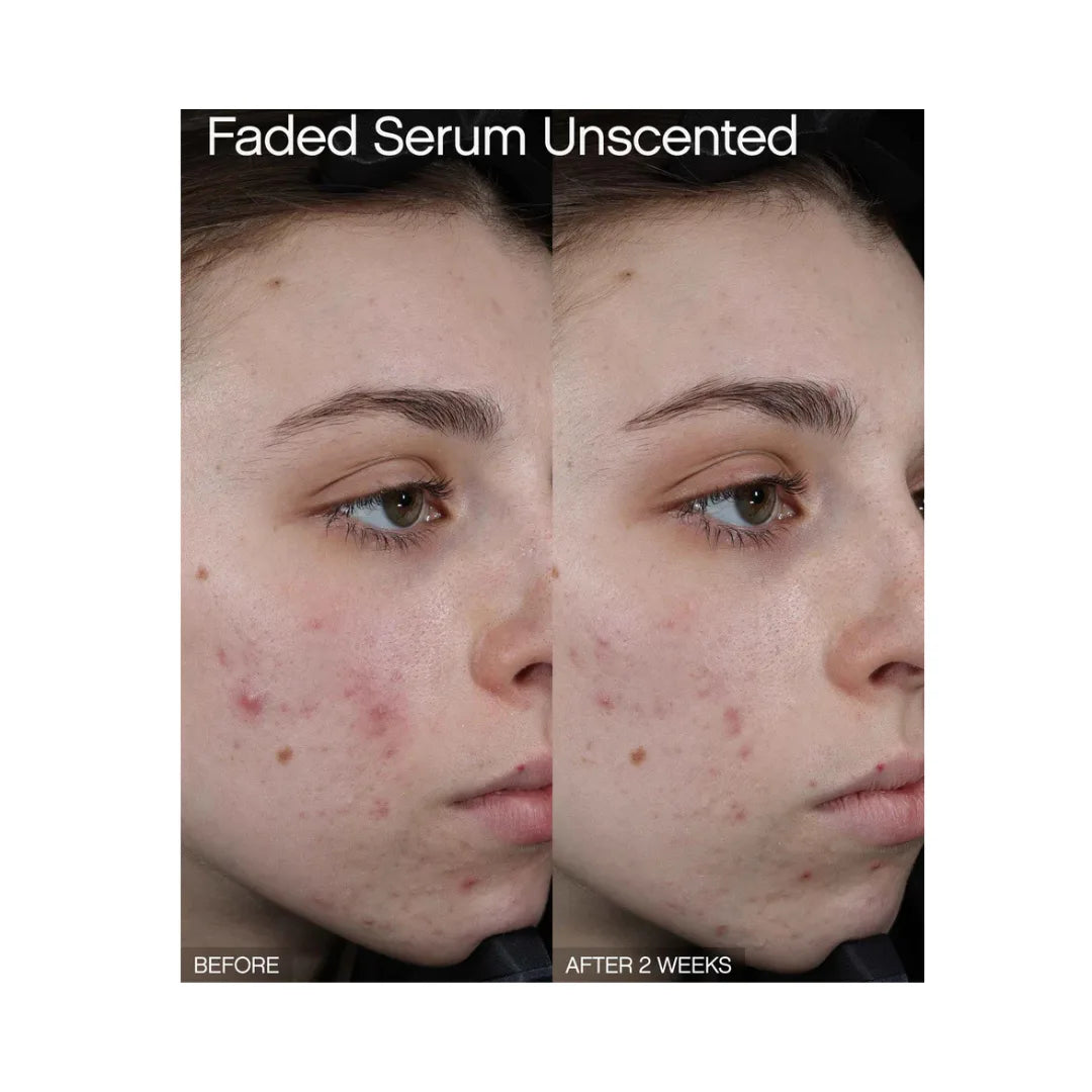 TROPICALS Faded Serum for Dark Spots & Discoloration