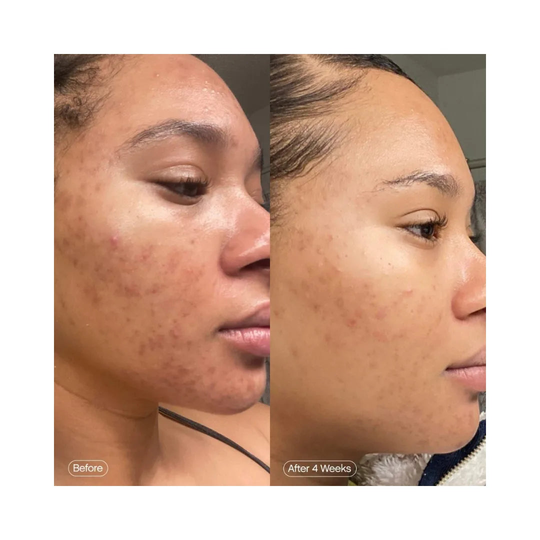 TROPICALS Faded Serum for Dark Spots & Discoloration