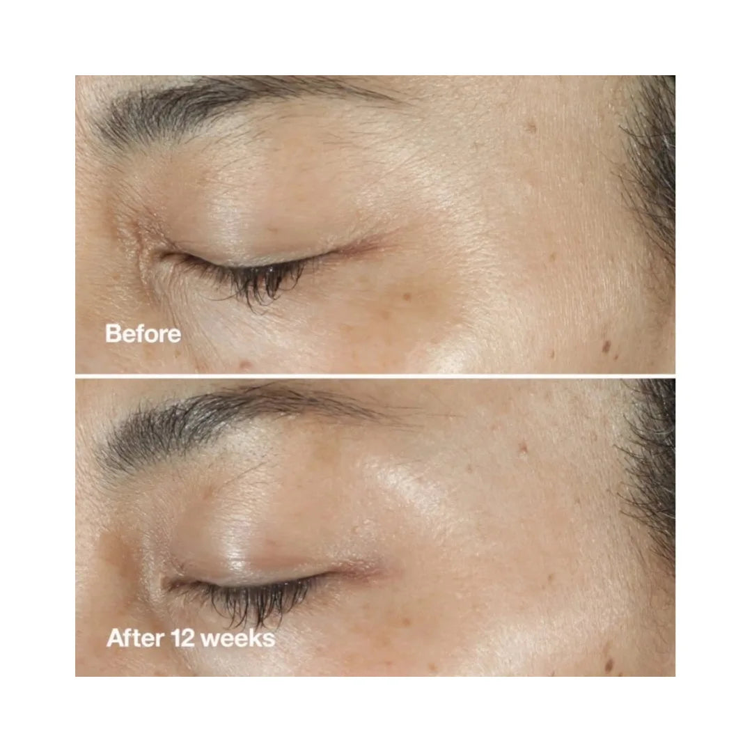 CLINIQUE Smart Clinical Repair Wrinkle Correcting Anti-Aging Eye Cream