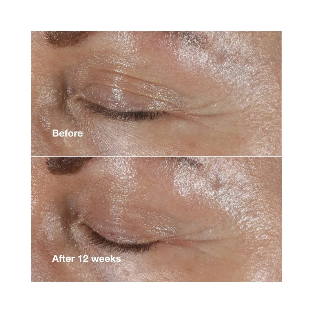 CLINIQUE Smart Clinical Repair Wrinkle Correcting Anti-Aging Eye Cream