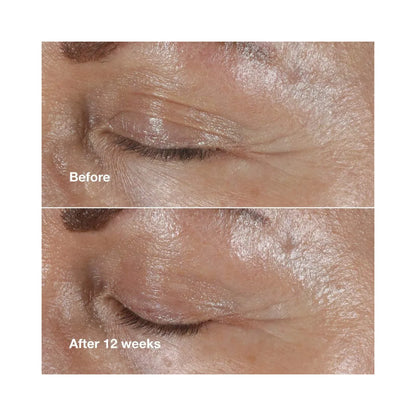 CLINIQUE Smart Clinical Repair Wrinkle Correcting Anti-Aging Eye Cream