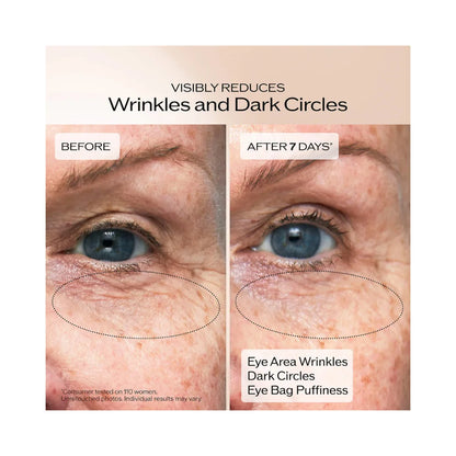 SHISEIDO Benefiance Wrinkle Smoothing Eye Cream
