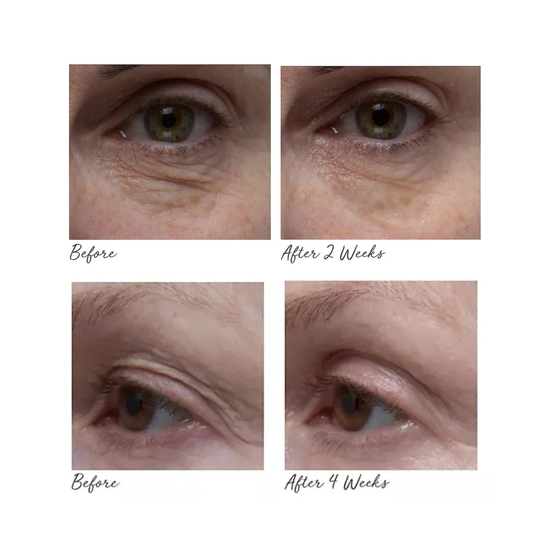 ELEMIS Peptide4 Eye Recovery Cream