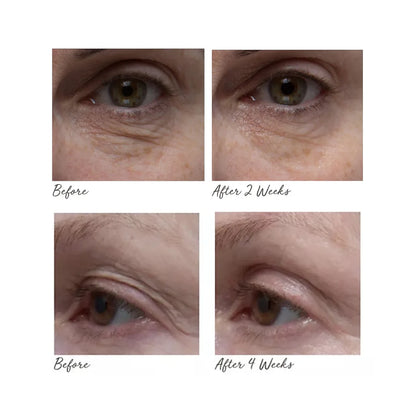 ELEMIS Peptide4 Eye Recovery Cream