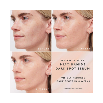 FENTY BEAUTY Watch Ya Tone Niacinamide Dark Spot Serum