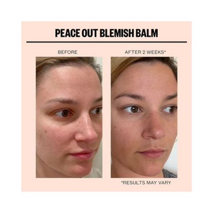 PEACE OUT Blemish Balm Cleanser